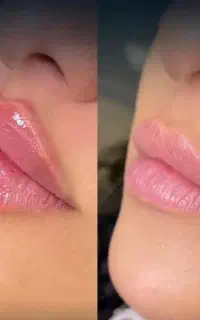 ژل لب با تکنیک m