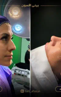 عمل بینی متخصص ENT تهران فقط ۴۵ میلیون در جشنواره