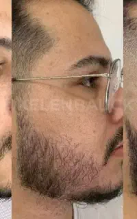 ریشای تو نشون دهنده اصالت تو اند