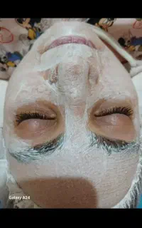 فیشال پوست تضمینی با پکیج اقتصادی (۳۷۰ تومن)