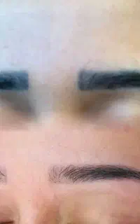 آموزش پاک کردن تتو و خدمات تخصصی
