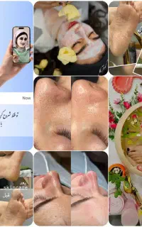 انجام خدمات پوستی(فیشال صورت،پدیکور کفسابی پا)