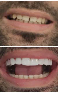 خدمات دندانپزشکی اقساطی