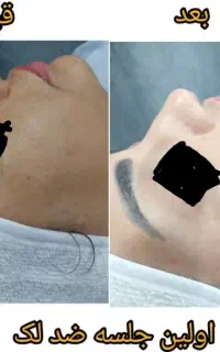 فیشیال با بهترین مواد اعتماد شما اعتبار ما