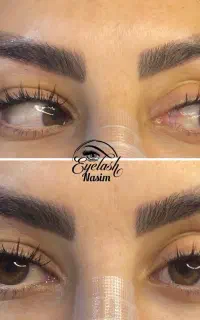 کاشت مژه هیدن