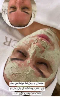 فیشال و پاکسازی