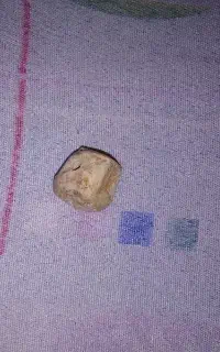 مهره