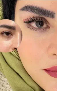 انجام اعمال جراحی زیبایی توسط جراح متخصص