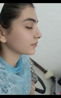 فشیال (پاکسازی پوست) خانم