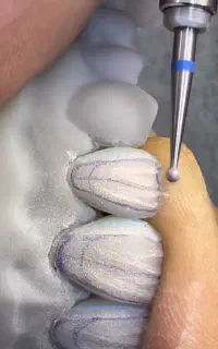 کار آموز دندانسازی