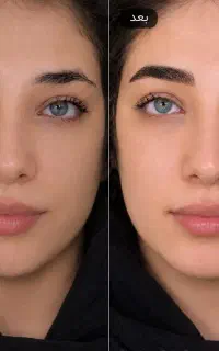 میکرو بلیدینگ ابرو  و فیبروز  دخترونه، مویی وطبیعی