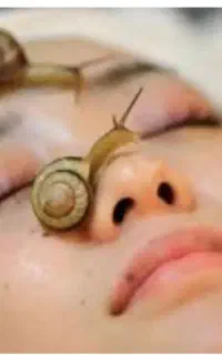 حلزون آلبینو آچاتینا