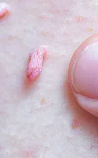 اچ  پی   وی   hp.v