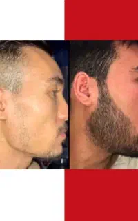 نوین ترین روش برای رویش