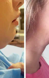 پذیرش انواع  جراحی های زیبایی دکتر ارسلان شیرویه