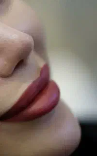 جراحی زیبایی بینی