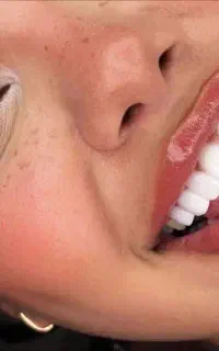 خدمات زیبایی و درمانی دندان از دم قسط با سفته