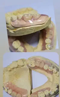دندانسازی تخصصی پروتز دندان