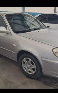 ورنا مدل‌ 87 فنی عالی