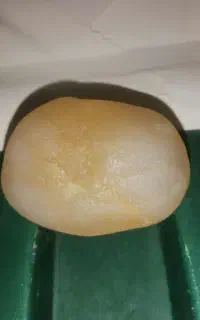 سنگ اصل کهربای قدیمی