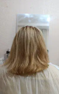 نیازمندمدل بوتاکس تراپی