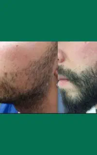 موهات حرف اول