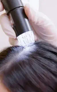اسکالپ پاکسازی کف سر