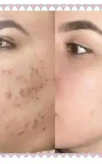 آموزش تخصصی خدمات پوست با تخفیف ویژه