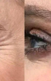 جوا.نی پوست با قدرت کرم های بیوم‌متیک