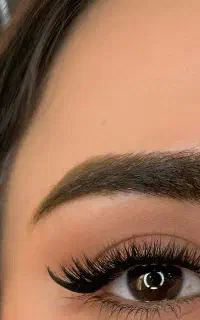 کاشت مژه هیدن با مناسبترین قیمت