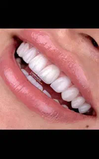 دونیروخانم جهت کاردر لابراتواردندانسازی و ویزیتور