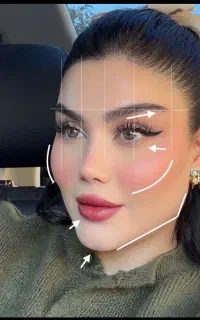 تزریق ژل وبوتاکس
