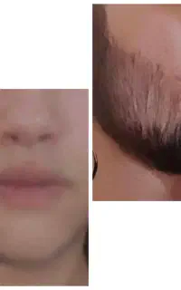 دیگه از نداشتن ریش رنج نکش
