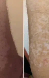از این قبل بیماری ها قابل درمان هم هستند