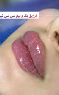 جشنواره کلینیک تخصصی ژل و بوتاکس