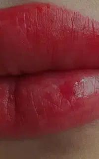 شیدینگ و میکروبلیدینگ،در عمارت  زیبایی کلاسیک