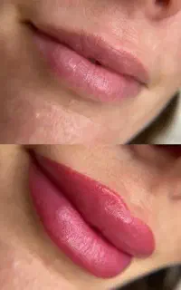 میکروبلیدینگ، روشن سازی و کاور تتو های قدیمی،شیدلب