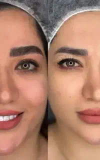 میکرو ابرو ،رژلب دائم،شیدینگ بدون درد،ریمووحرفه ای