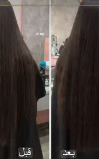 موخوره گیری و بافت مو
