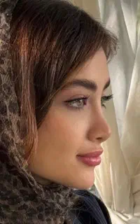 جراحی بینی برای مراجعین لردگان/انجام عمل درتهران