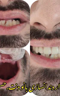 دندانسازی بانو دنت.شرایطی