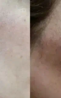 پوست سفید خاستین در خدمتم