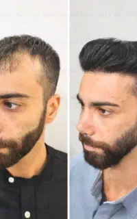 بمب معجزه