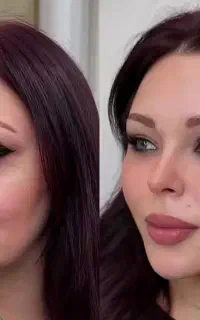 مدل زیباسازی وجوانسازی شفاف ولیف صورت به مدت محدود