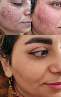 خال برداری، صافی مو کراتین وپروتین و آموزش