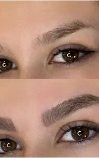 میکروبلیدینگ   تخفیف ویژه برای ۷ نفر اول