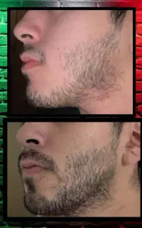 خیالت راحت بدون بازگشت ریش سبیل