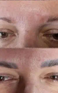 ریموتاتو وپاک کردن تاتو.ریموو ابروریمووخط چشم