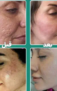کلینیک لیزر و زیبایی مهرگان (مجهزترین مرکز لیزر )