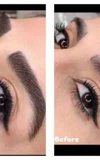 میکرو بلیدینگ و فیبروزابرو